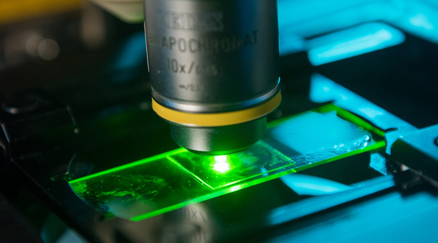 Closeup of a lab sample being studied under the objective lens of a microscope