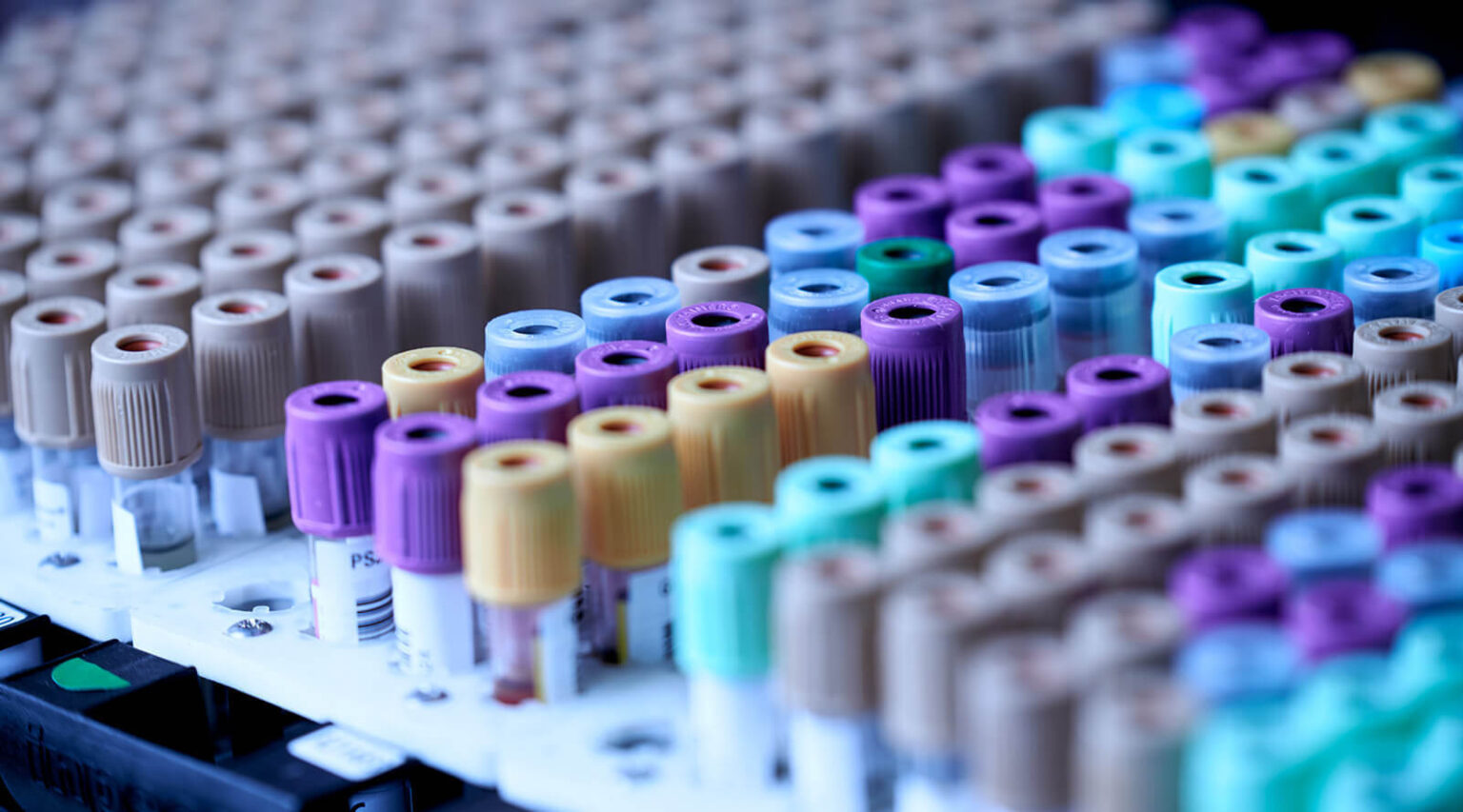 Closeup of a tray of test tubes with caps of different colors