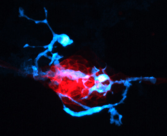Image of Neuromast and macrophage