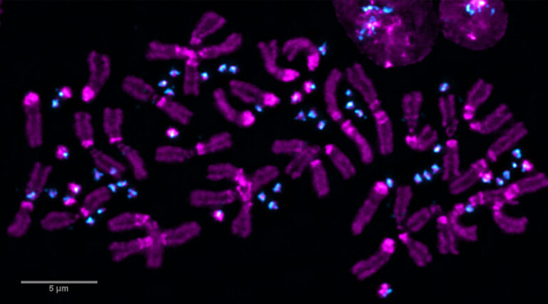 Microscopic image of chromosomes