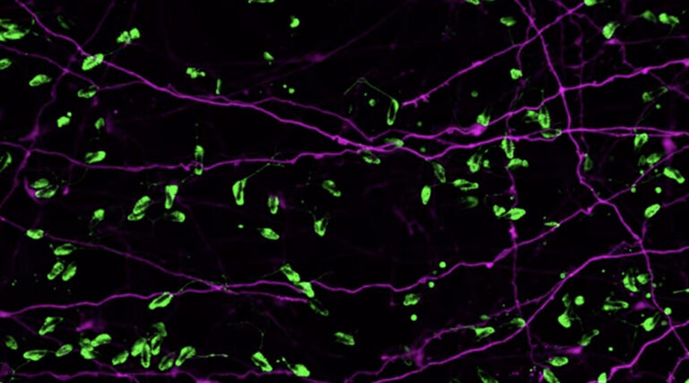 Sea anemone neurons and stinging cells
